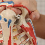 https://www.hcd.ie/2023/02/21/subacromial-impingement/
